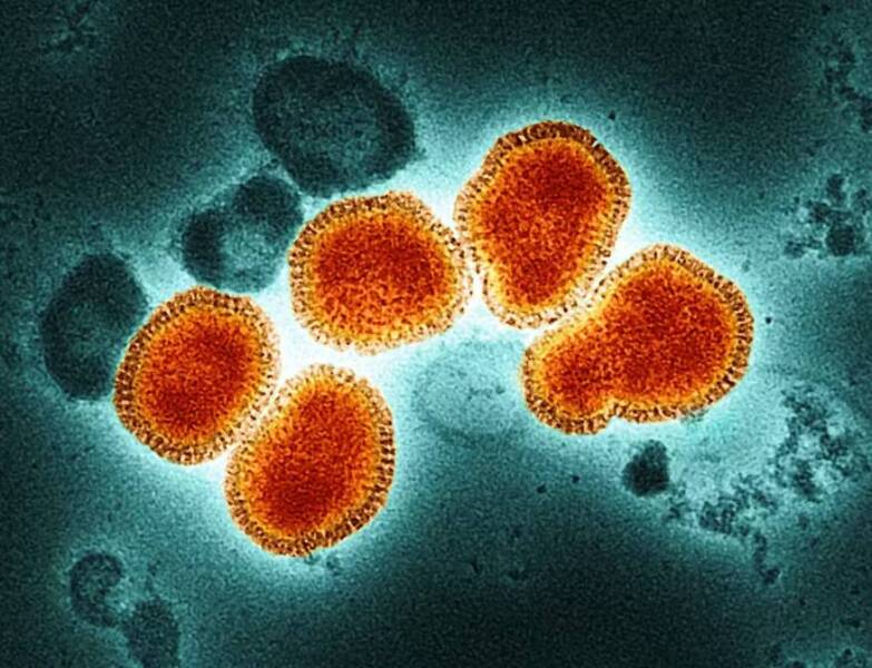 Scientists warn about which virus could cause the next pandemic